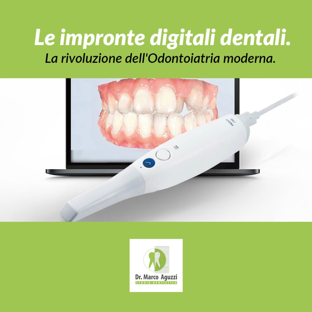 Le Impronte Digitali Dentali