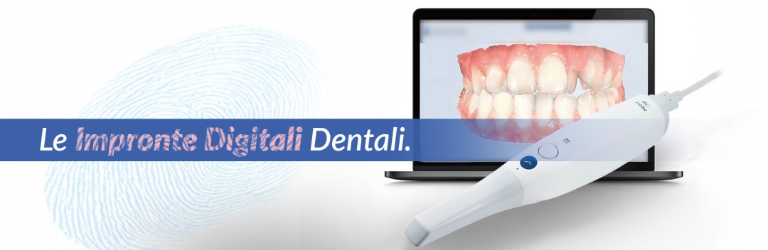 Lo scanner intraorale per le impronte digitali dentali
